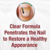 Kerasal Multi-Purpose Nail Repair, 0.43 fl oz - Kerasal